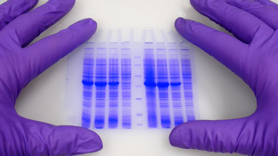 آنالیز وسترن بلات و Realtime PCR انواع ژن و پروتئین